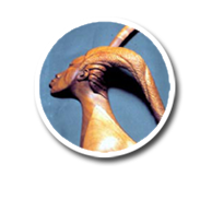 Wood Link